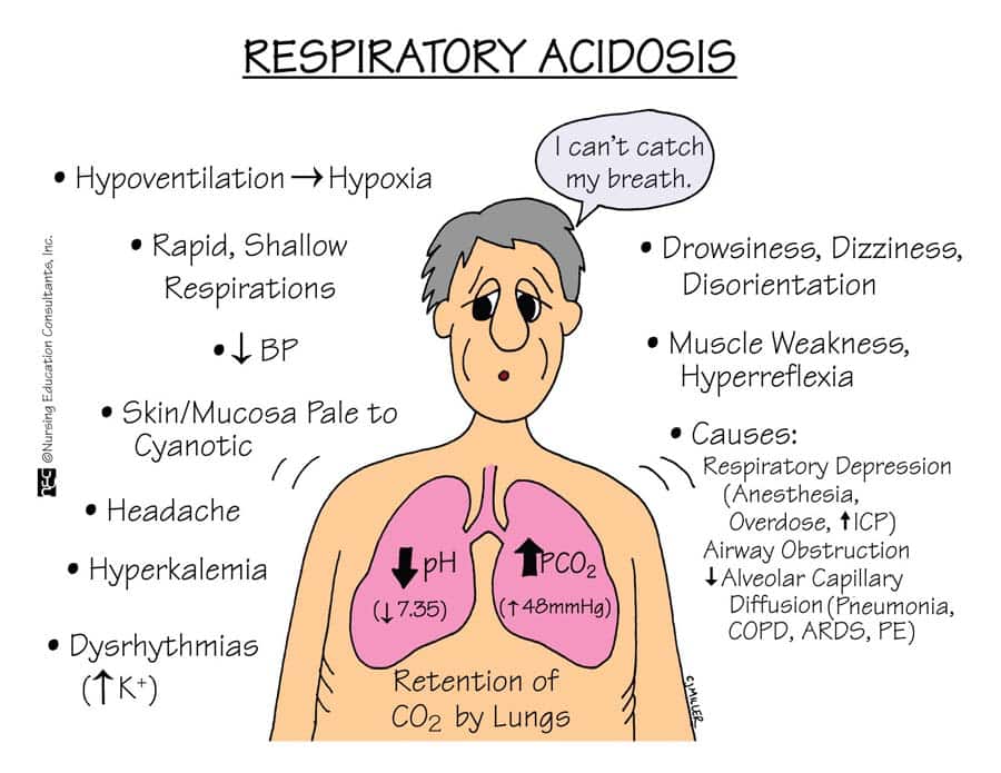 types-of-lung-failure-respiratory-therapy-student-medical-surgical