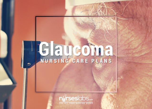 Glaucoma Glaucoma