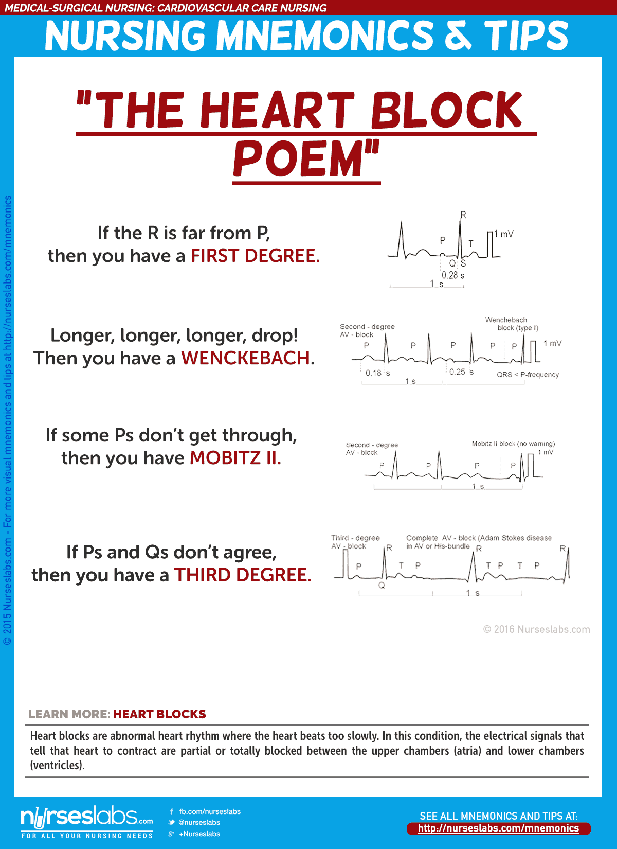 Cardiovascular Care Nursing Mnemonics and Tips Nurseslabs