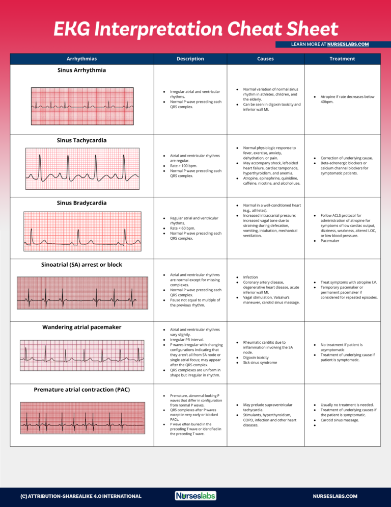 Cardiac Ecg Flashcards Pdf Anatomy Flashcards Flashcards Sinus Rhythm ...