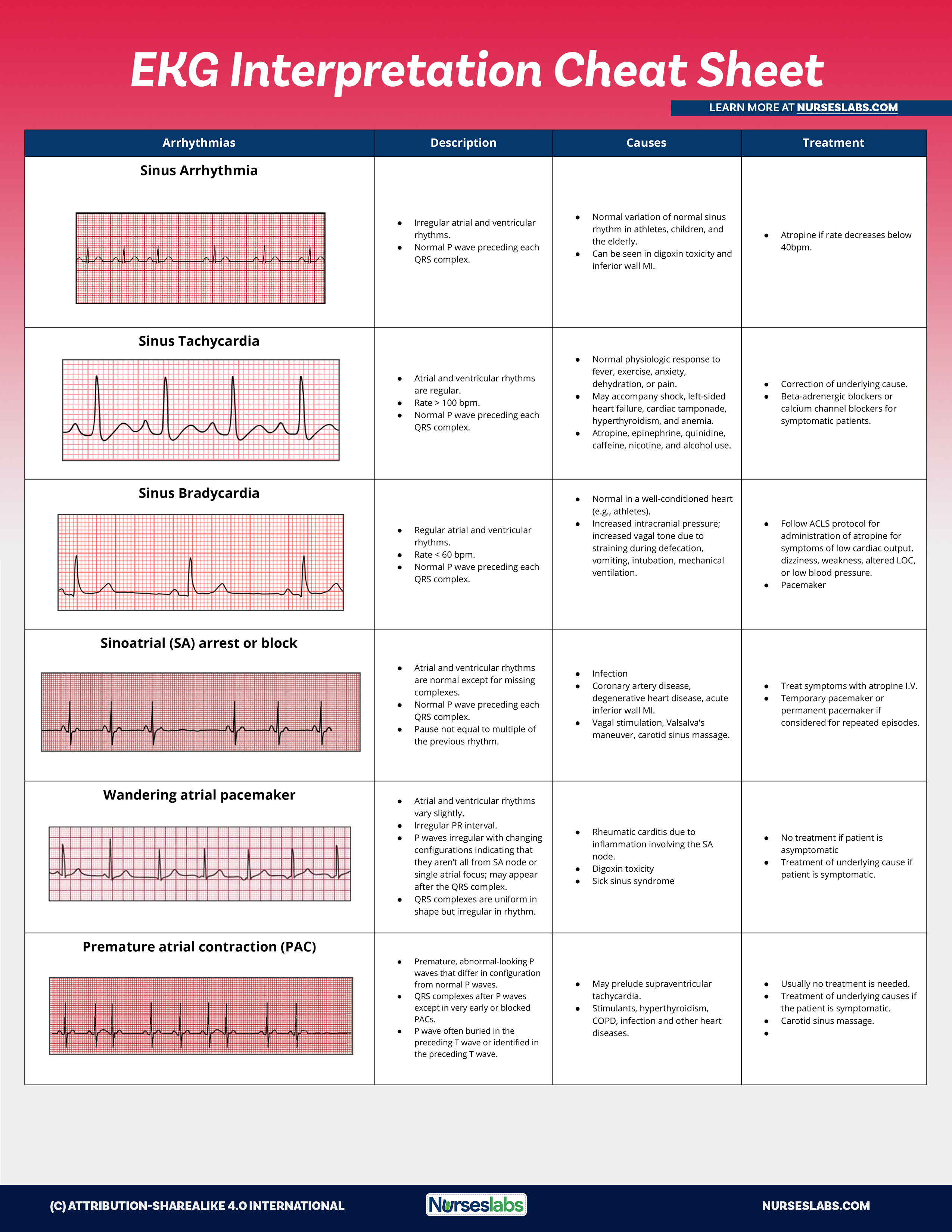 Printable Ekg Cheat Sheet