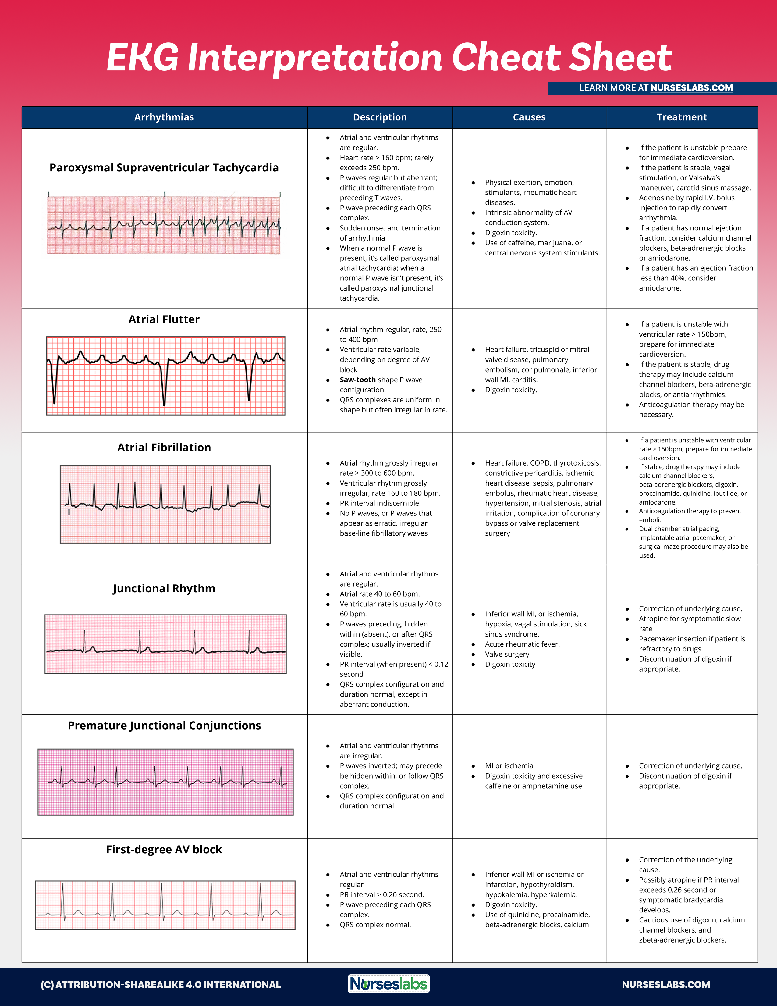 Free Printable Ekg Interpretation Cheat Sheet