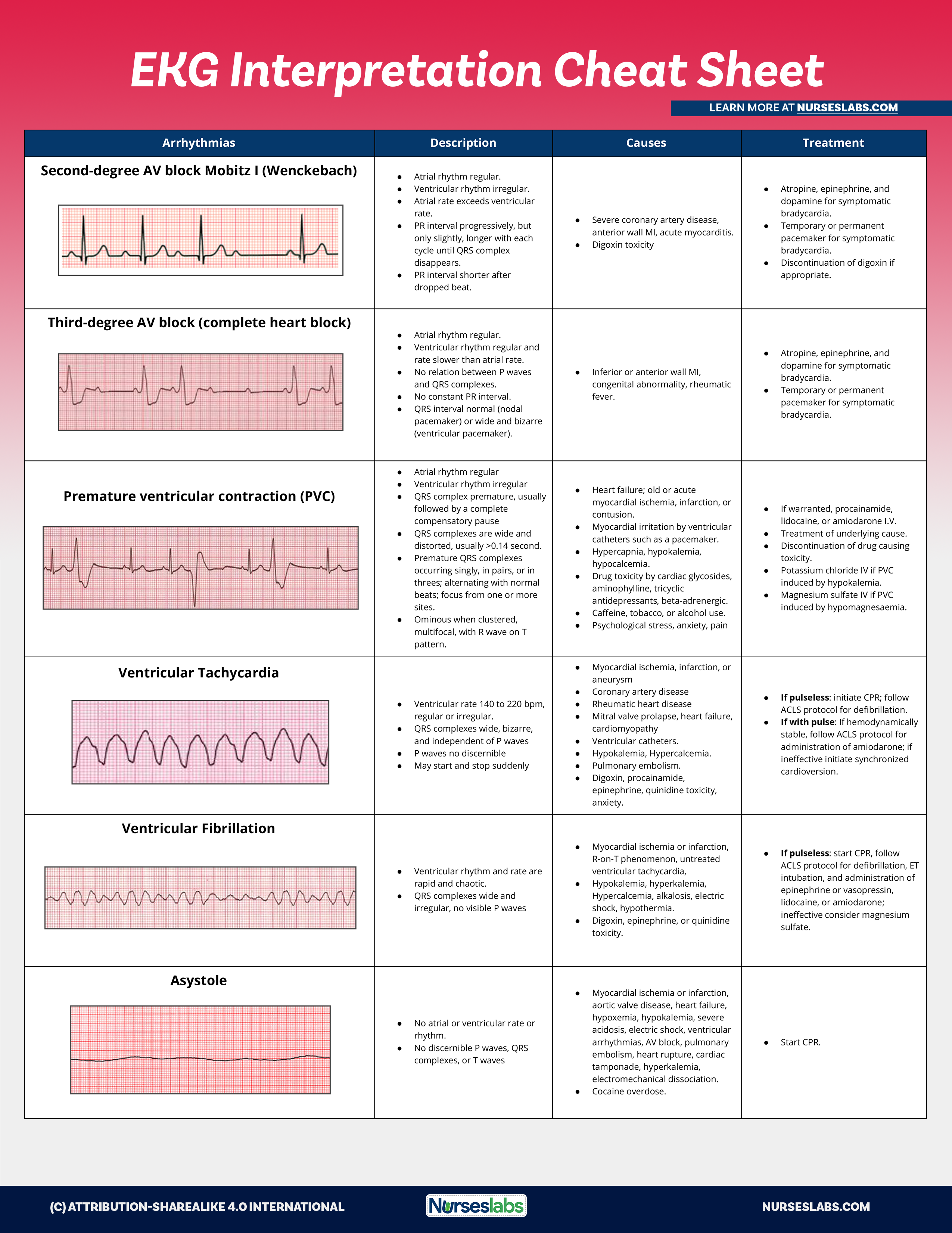 EKG Interpretation Cheat Sheet & Heart Arrhythmias Guide (2020 Update)