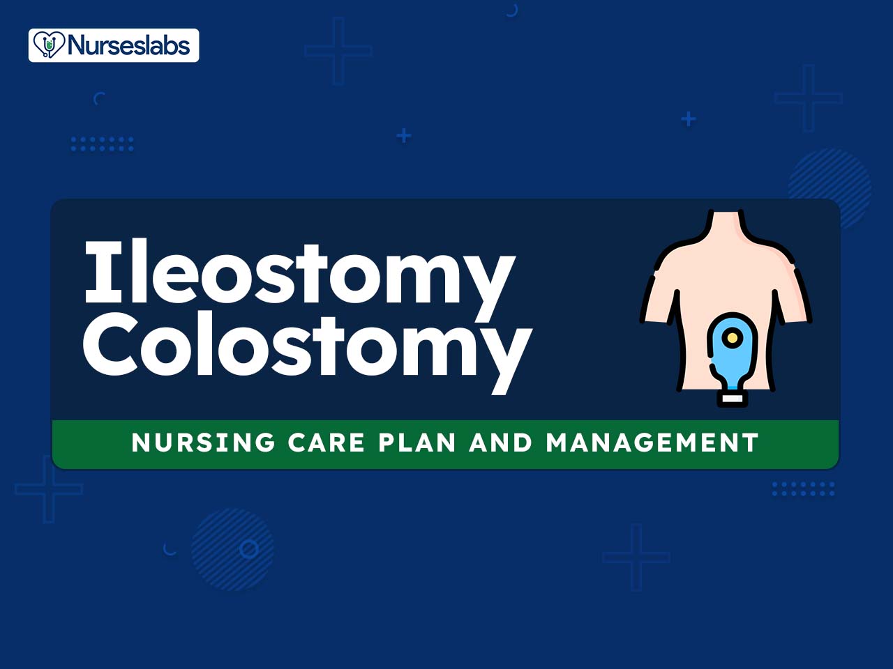 Ileostomy vs. Colostomy: Surgery, Location, Recovery