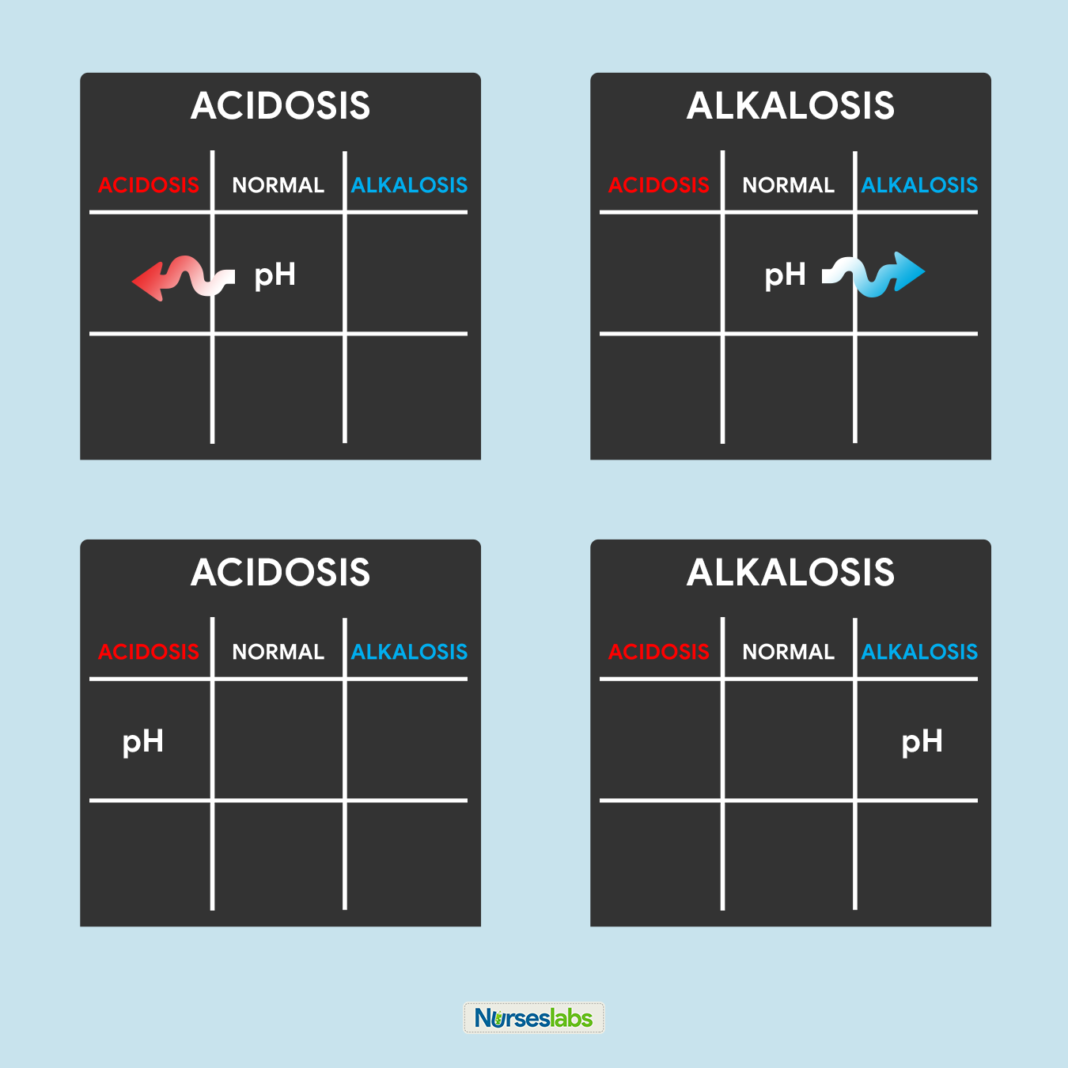 8Step Guide to ABG Analysis TicTacToe Method Nurseslabs
