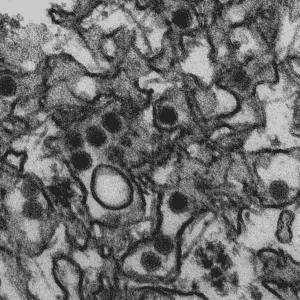 Electron micrograph of Zika virus. Virus particles are 40 nm in diameter, with an outer envelope and a dense inner core. Via: CDC.gov