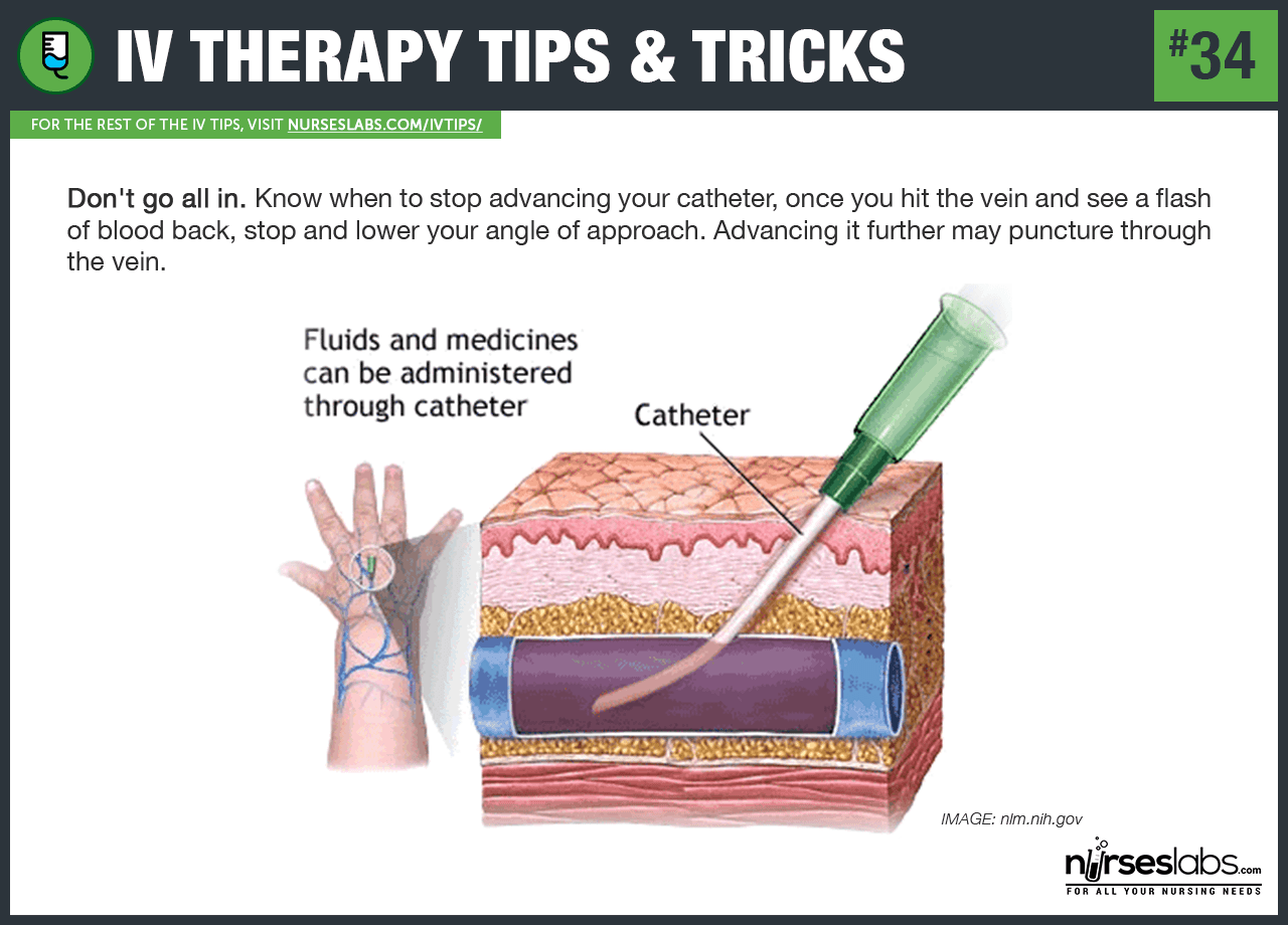 IV Therapy: Tubing  Have Dummy Will Travel