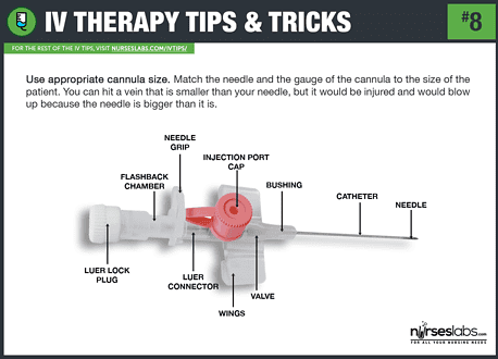 55 IV Therapy Tips and Tricks: How to Hit the Vein in One Shot ...