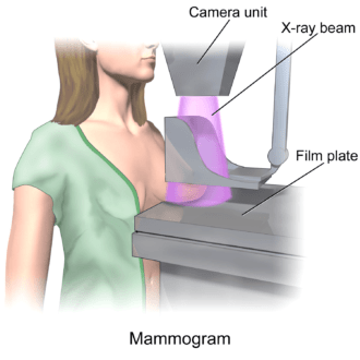 Mammogram. Image via: Wikipedia. 