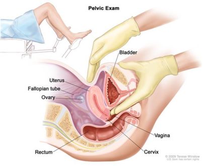 Pelvic exam