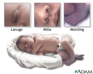 The Newborn: Profile, Appearance and Adjustments