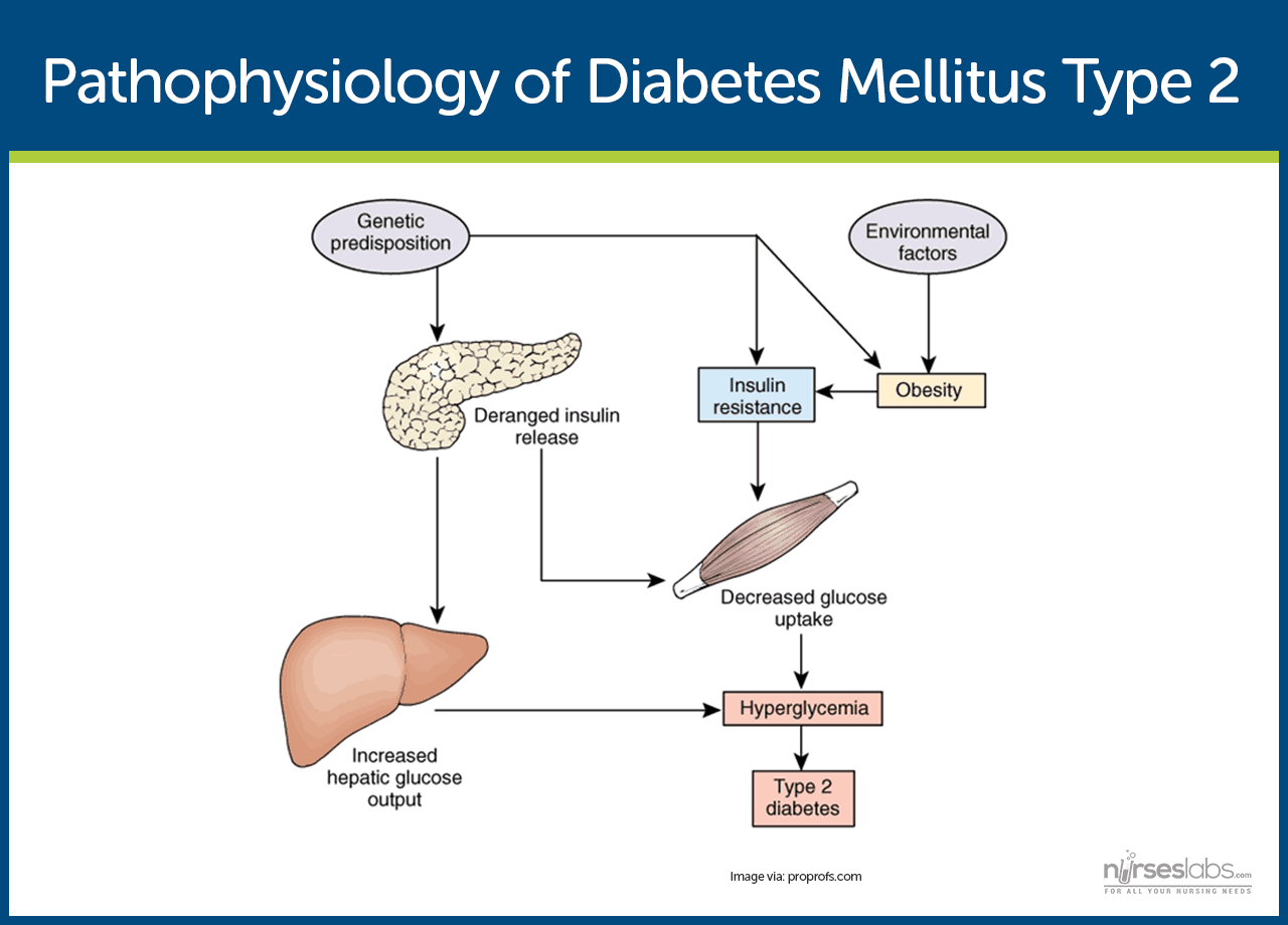 classic presentation of diabetes mellitus type 2