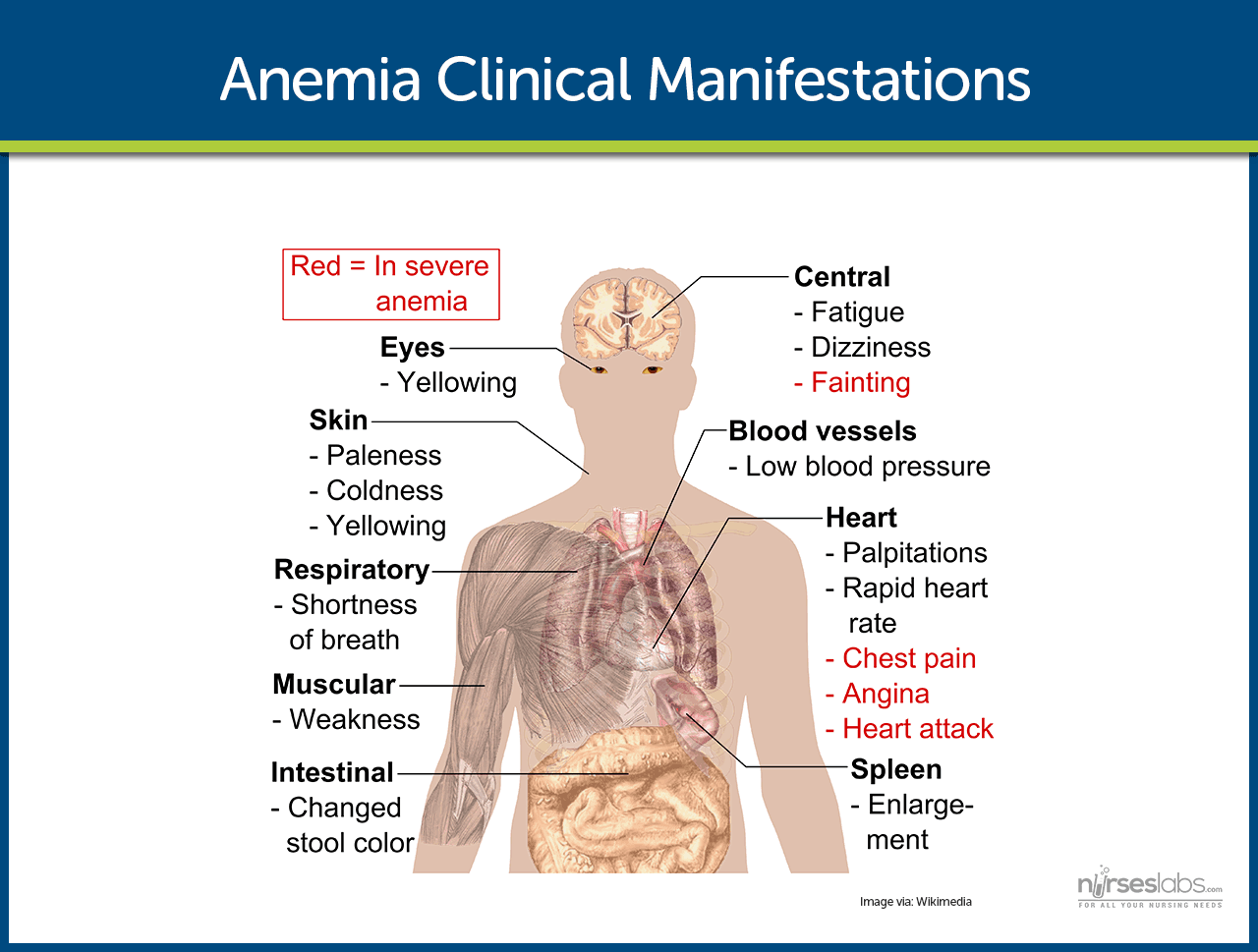 Anemia Clinical Manifestations