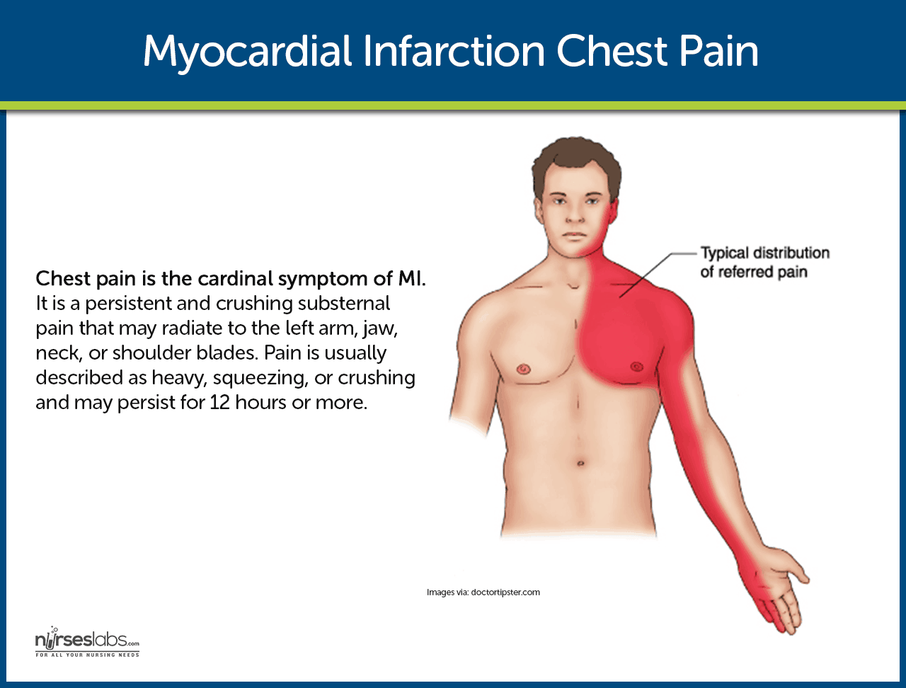 Location of Chest Pain During Myocardial Infarction