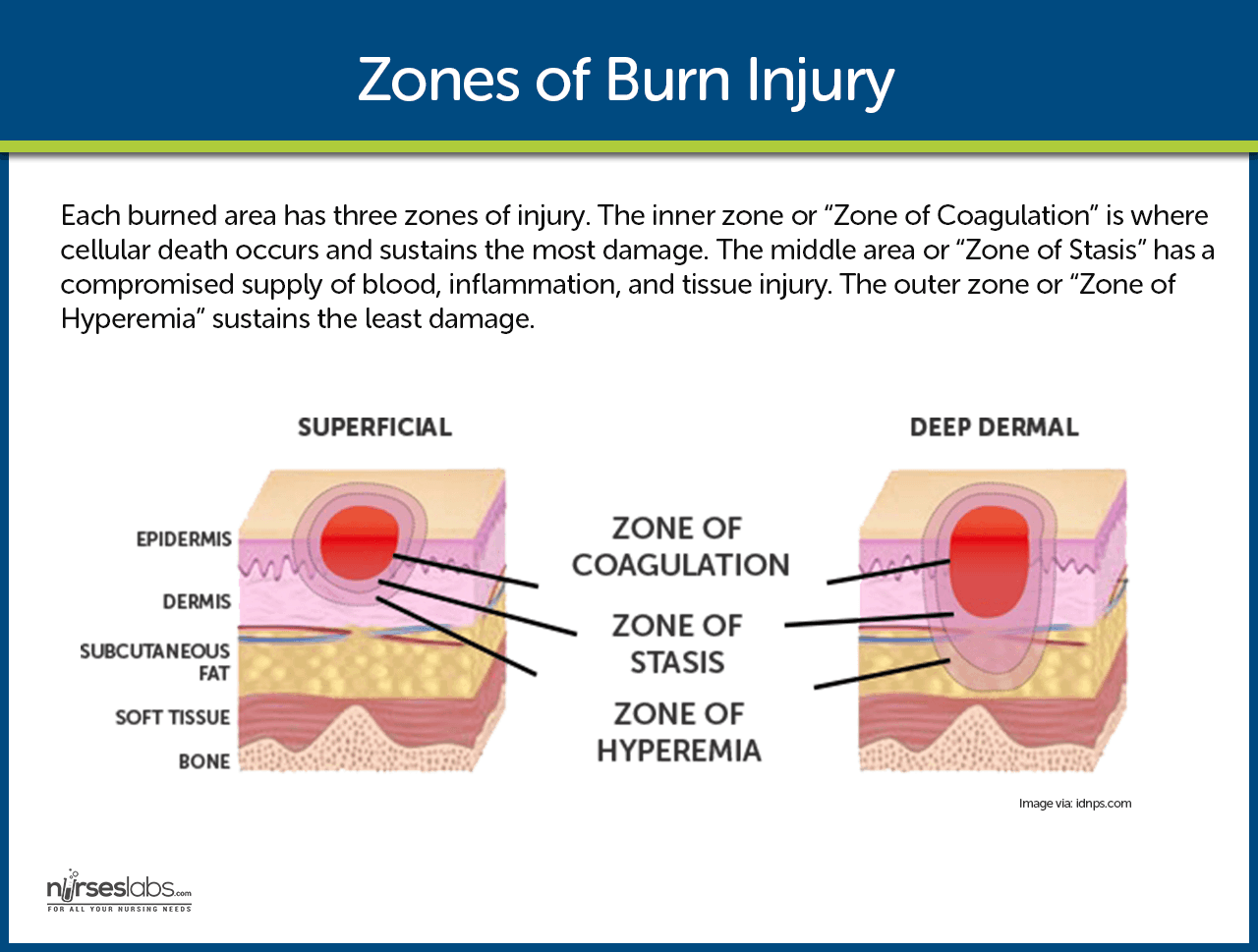 Burn Injury Nursing Care Management and Study Guide