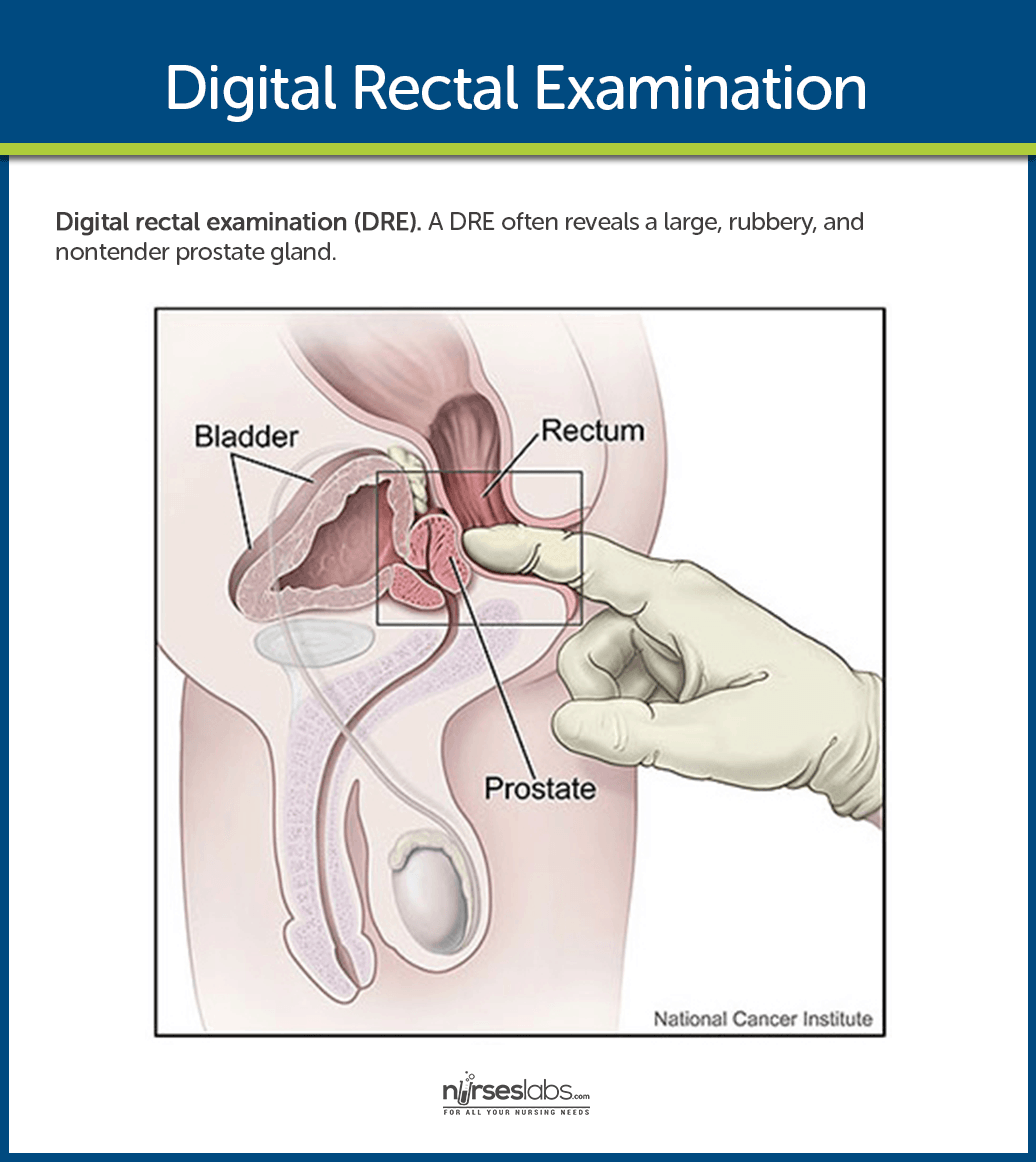 Digital Rectal Examination