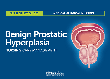 Management Of Bph Ppt | Benign Prostatic Hyperplasia (BPH) | LUGBJ