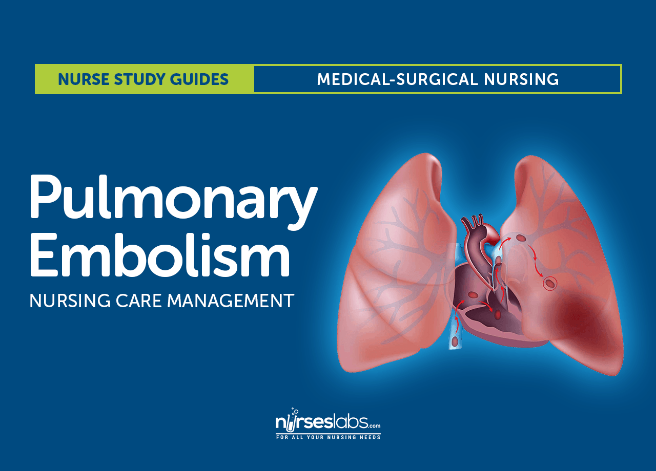 Pulmonary Embolism Nursing Care and Management: Study Guide