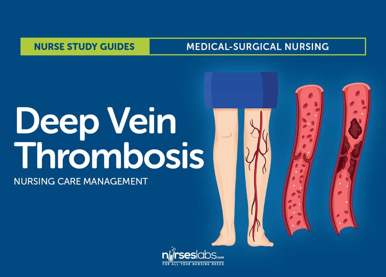 Deep Vein Thrombosis Anatomical Chart