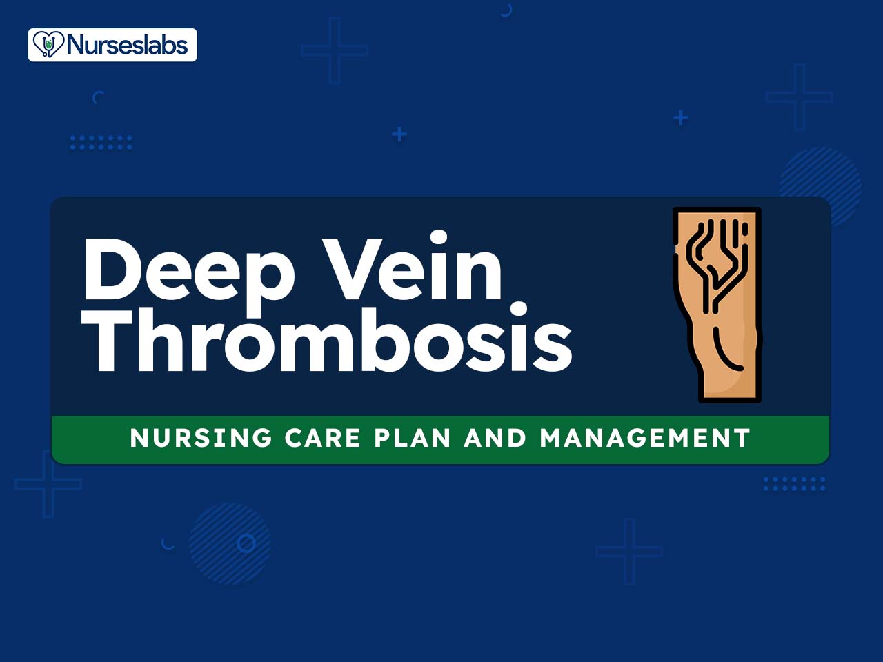 Deep Vein Thrombosis: Symptoms, Causes & Prevention