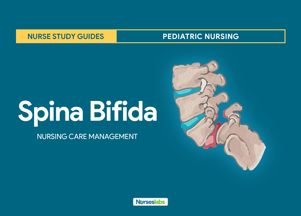 diagnosis what nursing Spina Study and Nursing Pediatric Bifida Guide Care Management