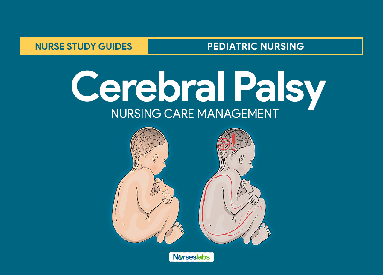 Athetoid Cerebral Palsy