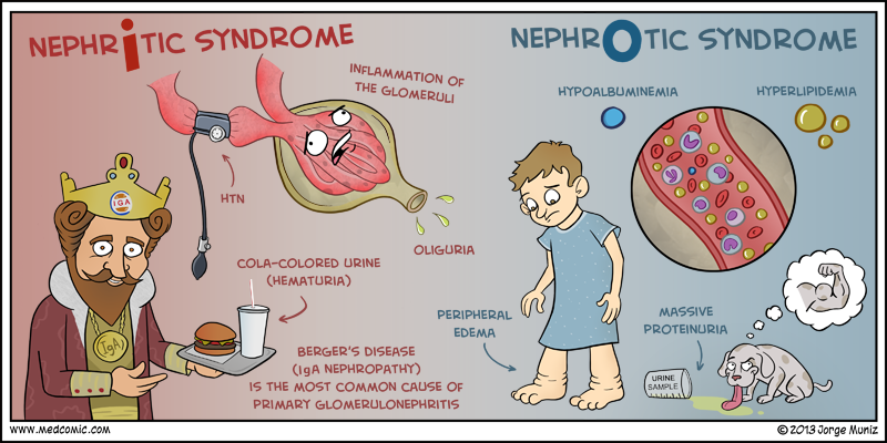 clinical presentation of nephrotic syndrome