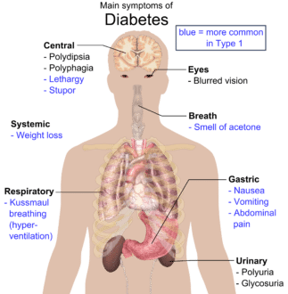 ati case study type 1 diabetes mellitus