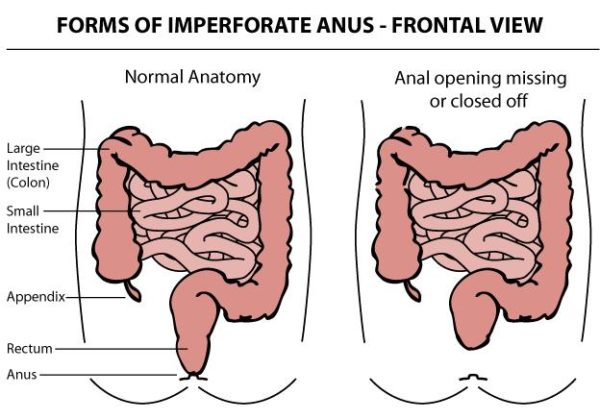 how to make a computer program speak anus