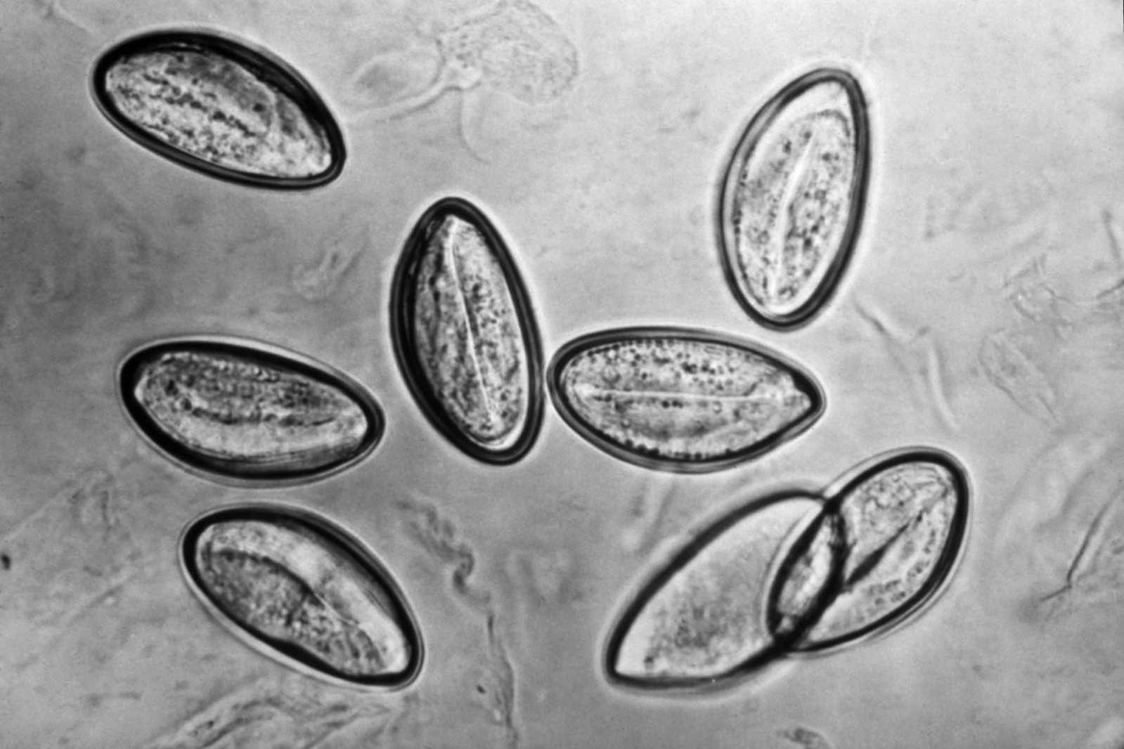 This photomicrograph depicts the eggs of the human parasite Enterobius vermicularis via cellulose tape under significant magnification.