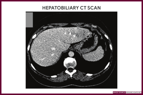 HEPATOBILIARY CT SCAN