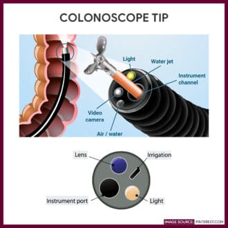 Smaller instruments on the tip of the colonoscope to perform various tasks like irrigation, lighting, and insertion of another instrument (for obtaining samples).