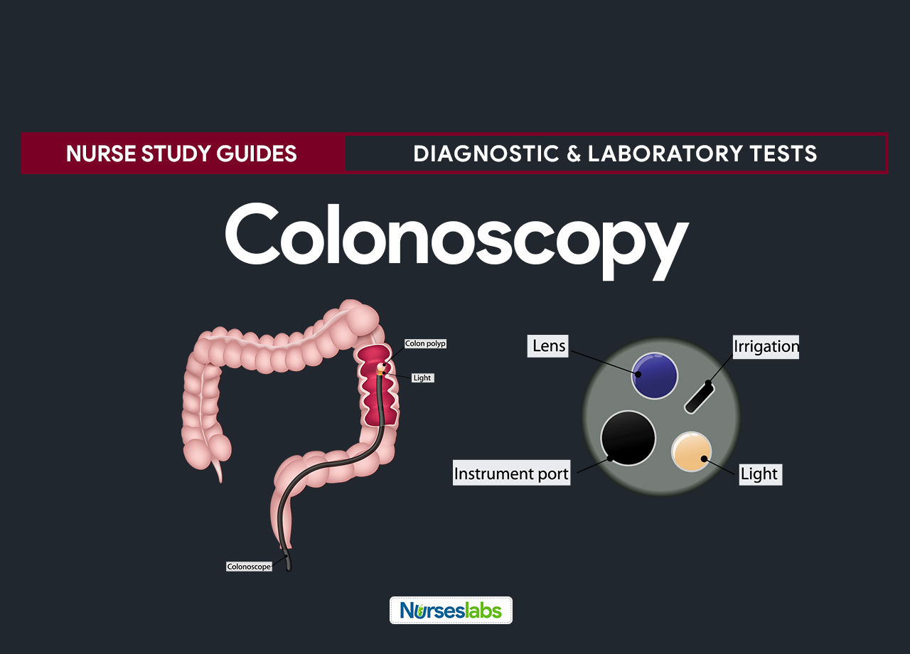 Colonoscopy Nursing Responsibilities and Procedures Nurseslabs