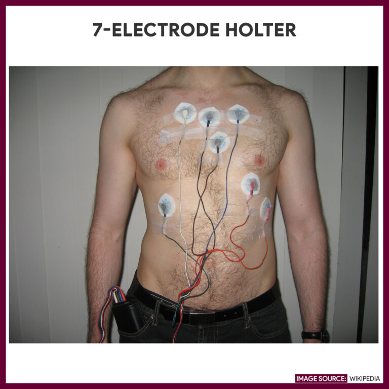 holter-monitoring-nursing-responsibilities-and-care-plan-nurseslabs