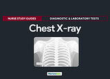 Chest X-ray (Chest Radiography) Nursing Care Management and Responsibilities
