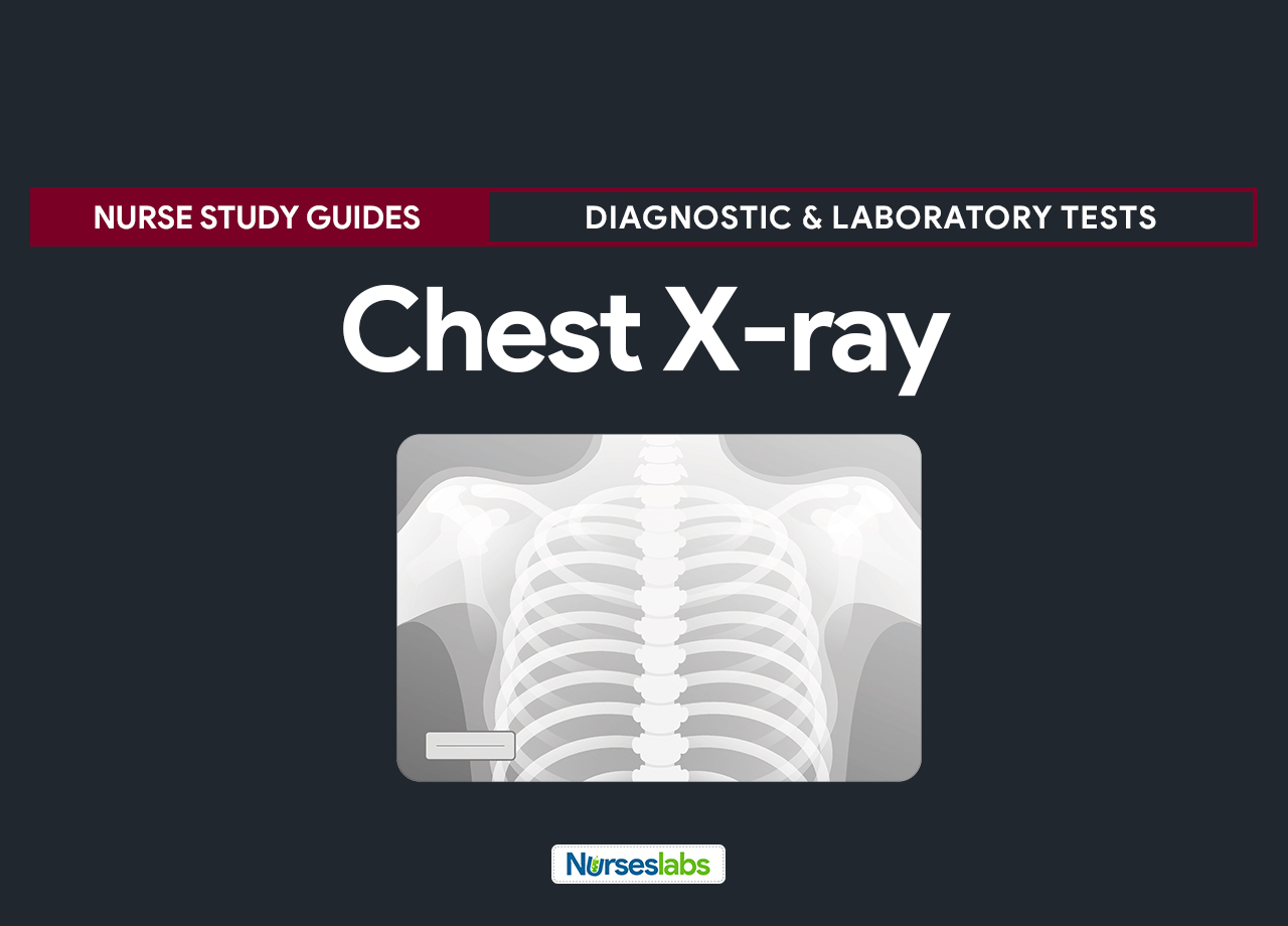 How To Diagnosis X Ray