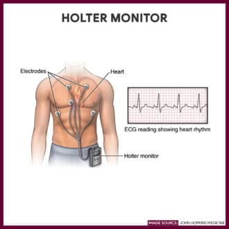 CPT CODE FOR HOLTER MONITOR 14 DAYS