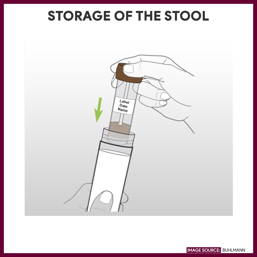 Storage of the stool
