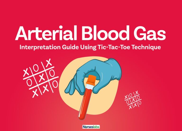FT–Arterial Blood Gas Analysis Made Easy with Tic-Tac-Toe Method
